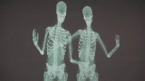 Viral Video Of Skeletons Proves Love Has No Labels Abc News