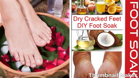 Lemon Vinegar Foot Soak For Callus Remover Toenail Fungus Dry Cracked