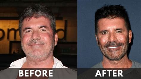 Simon Cowell Weight Loss 2024 Before And After