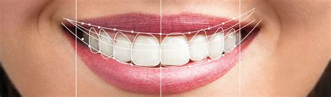 Dental Design Smile Procedure Design Talk