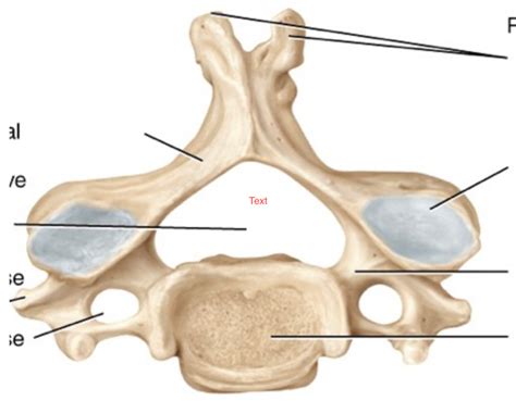 Typical Cervical Vertebra Superior View Diagram Quizlet