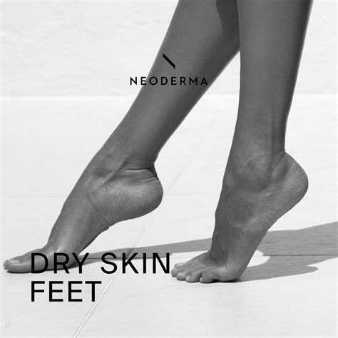 Dry Skin Feet Moisturizer Neoderma