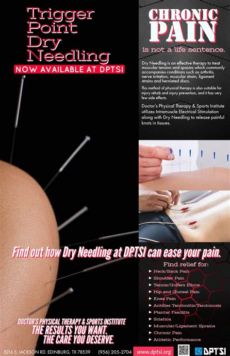 dry needling doctors physical therapy and sports institute