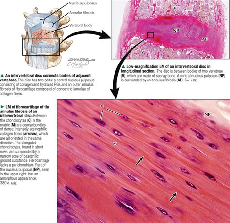 Cartilage And Bone Basicmedical Key