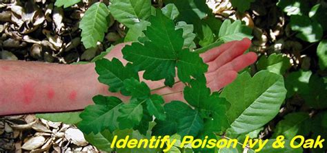 How To Identify Poison Ivy Oak And Sumac And Treatments Remedies