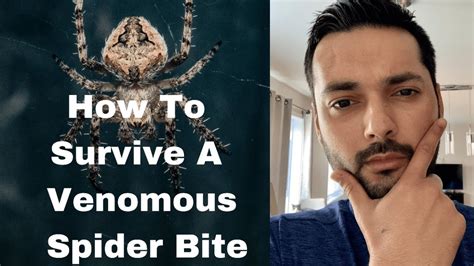 How To Survive A Venomous Spider Bite Youtube