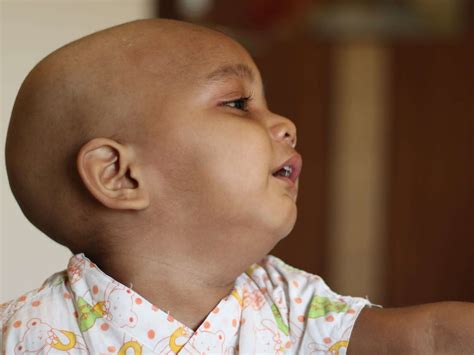 Babies Her Age Can Barely Turn Over And Shes Fighting Deadly Cancer