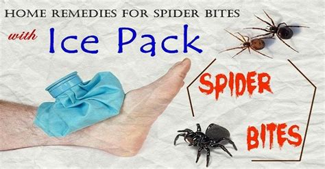 16 Natural Home Remedies For Spider Bites You Should Know Home