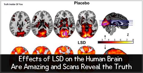 Effects Of Lsd On The Human Brain Are Trippy And Scans Reveal The Truth Truth Inside Of You