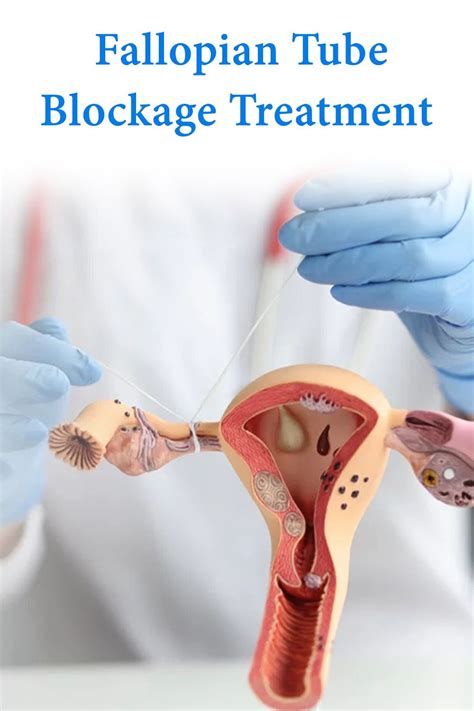 Blocked Fallopian Tubes Symptoms Treatment Symptoms Of Blocked