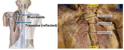 Duke Anatomy Lab 1 Skin And Epaxial Muscles