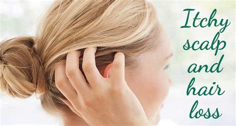 Itchy Scalp And Hair Loss Reveal The Relation Laylahair