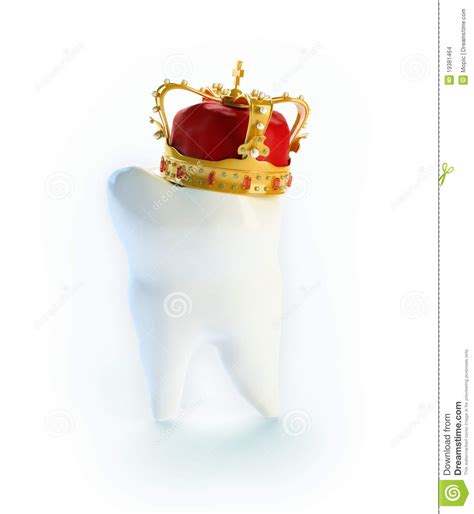 Der zahn wird auch unter dem zahnfleisch abgeschliffen, damit sich die enden und seiten der krone unter dem zahnfleisch befinden. Zahn mit einer Krone stock abbildung. Illustration von ...
