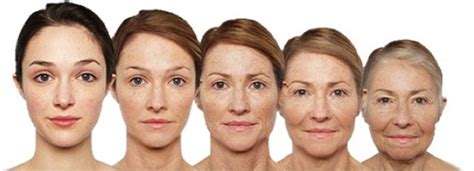 Aging Face Cheeks