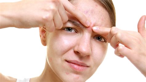 Is Popping Pimples Bad For You