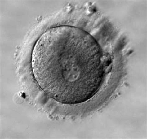 Conventionally, a zygote is considered to be formed the moment that a spermatozoum, penetrates the cell membrane of the ovum and yields its genetic material into the ovum. File:Human zygote two pronuclei 03.jpg - Embryology
