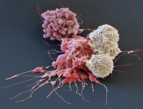 White Blood Cells Attacking Cancer Bild Kaufen 13243984 Science