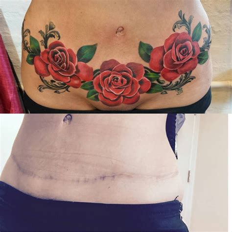 27 Tattoos That Cover Up Tummy Tuck Scars References