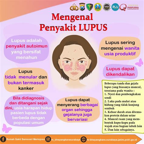 Rs Bhayangkara Surabaya Mengenal Penyakit Lupus Penyakit Autoimun