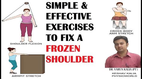 Simple And Effective Exercises To Fix A Frozen Shoulder Youtube