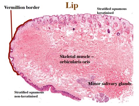 Vermilion Border Of Lip Histology