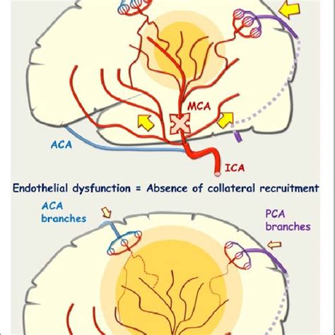 Collateral Recruitment After Middle Cerebral Artery Occlusion MCA Download Scientific Diagram