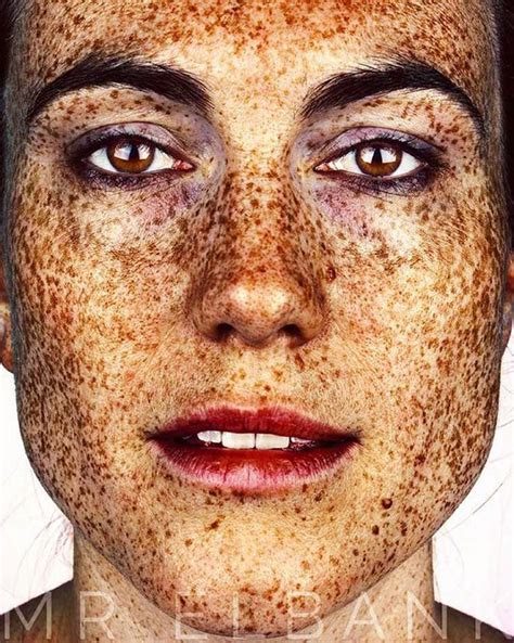 Photographer Takes Portraits Of Freckled People To Celebrate Their