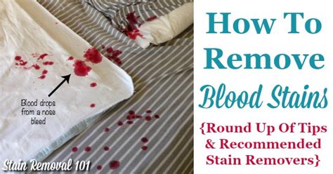 How To Remove Blood Stains Round Up Of Tips And Stain Remover