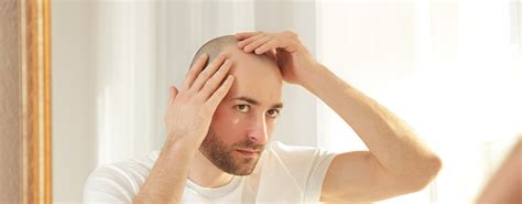 Perte Brutale Des Cheveux Après Une Greffe Clinicana