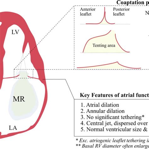 Key Features In Atrial Functional Mitral And Tricuspid Regurgitation