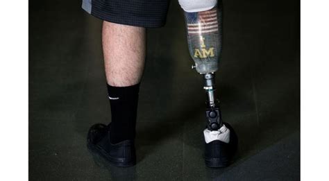 Amputees Can Now Feel Their Feet Just Like A Real Leg Thanks To This