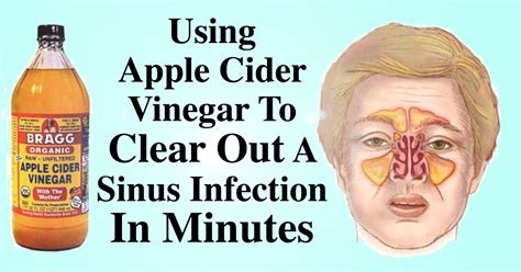 How To Clear Out A Sinus Infection Within Minutes Drinking 2 Tbsp Of