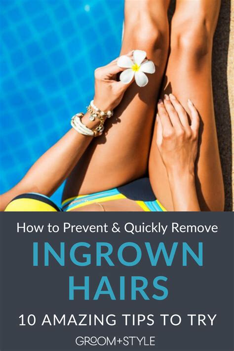 How To Remove And Prevent Ingrown Hairs Fast In 2021 Ingrown Hair Ingrown Hair Removal
