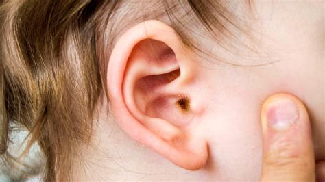 Ear Wax Draining From Toddler Best Drain Photos Primagemorg