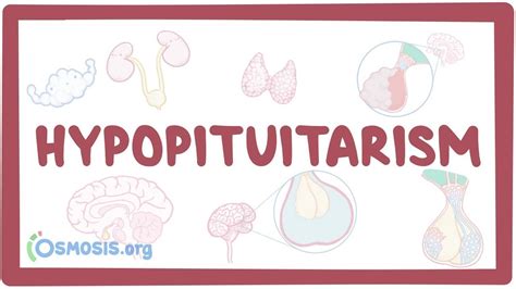 Hypopituitarism Causes Symptoms Diagnosis Treatment Pathology