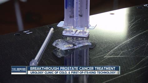Breakthrough Prostate Cancer Treatment From Colorado Now FDA Approved YouTube