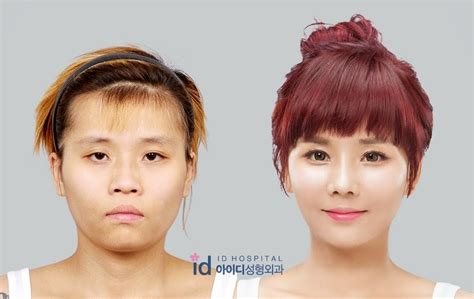 This Plastic Surgery Makeover Show From South Korea Is Insane Life
