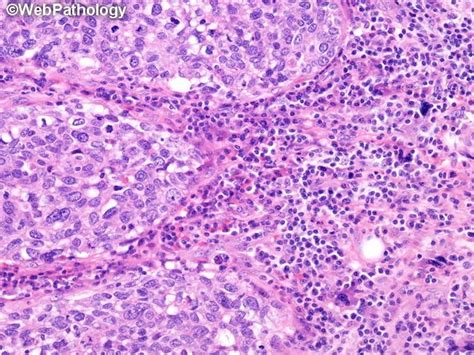 A Collection Of Surgical Pathology Images Gene