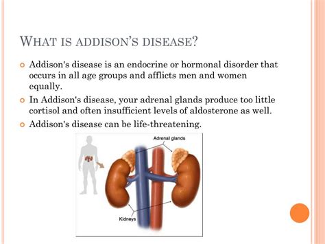 Ppt Addison’s Disease Powerpoint Presentation Free Download Id 3908216