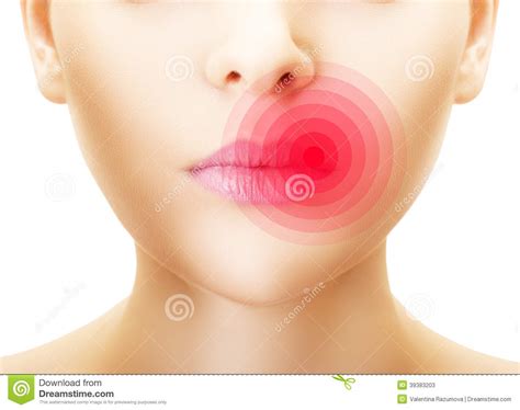 Labbra colpite da herpes. immagine stock. Immagine di circostanza - 39383203