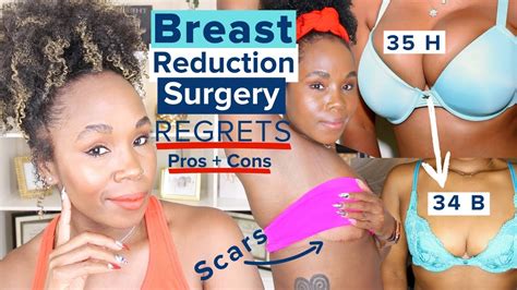 My Breast Reduction And Breast Lift Regrets Plastic Surgery Pros