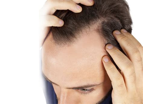 The procedures can alleviate hair loss, promote hair growth, and enhance your appearance. Hair Loss Clinic Manchester| Hair Loss Treatment | Halo ...