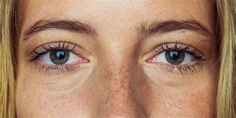 However, many drops should never be placed on your eye while you are wearing your lenses. Should You Use Preparation H Under Eyes? | SELF
