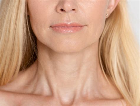 Difference Between Normal Neck And Goiter Difference Between