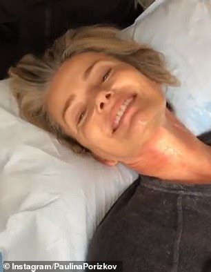 Paulina Porizkova Reveals Non Invasive Neck Tightening Treatment She