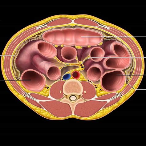 Imaging Approach To The Peritoneum Mesentery And Abdominal Wall