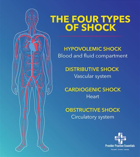 6 Types Of Shock