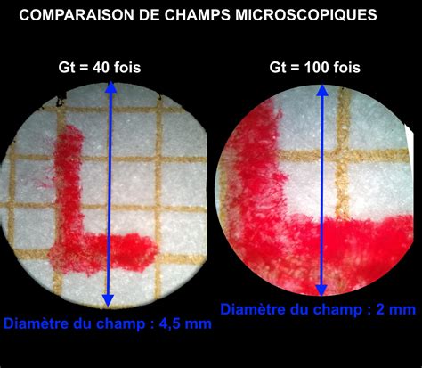 Initiation Aux Techniques Microscopiques And étalonnage De La Chaîne De