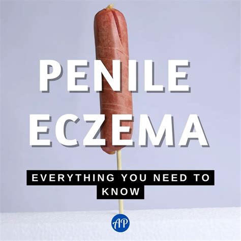 Penile Eczema Everything You Need To Know