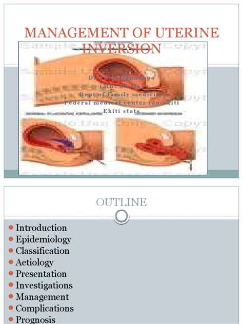 Management Of Uterine Inversion Uterus Childbirth